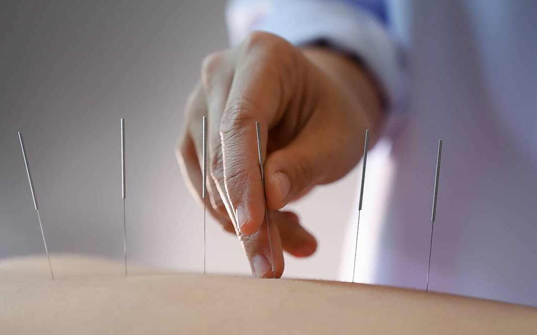 8 Benefits of Going to a Chinese Medicine and Acupuncture Clinic