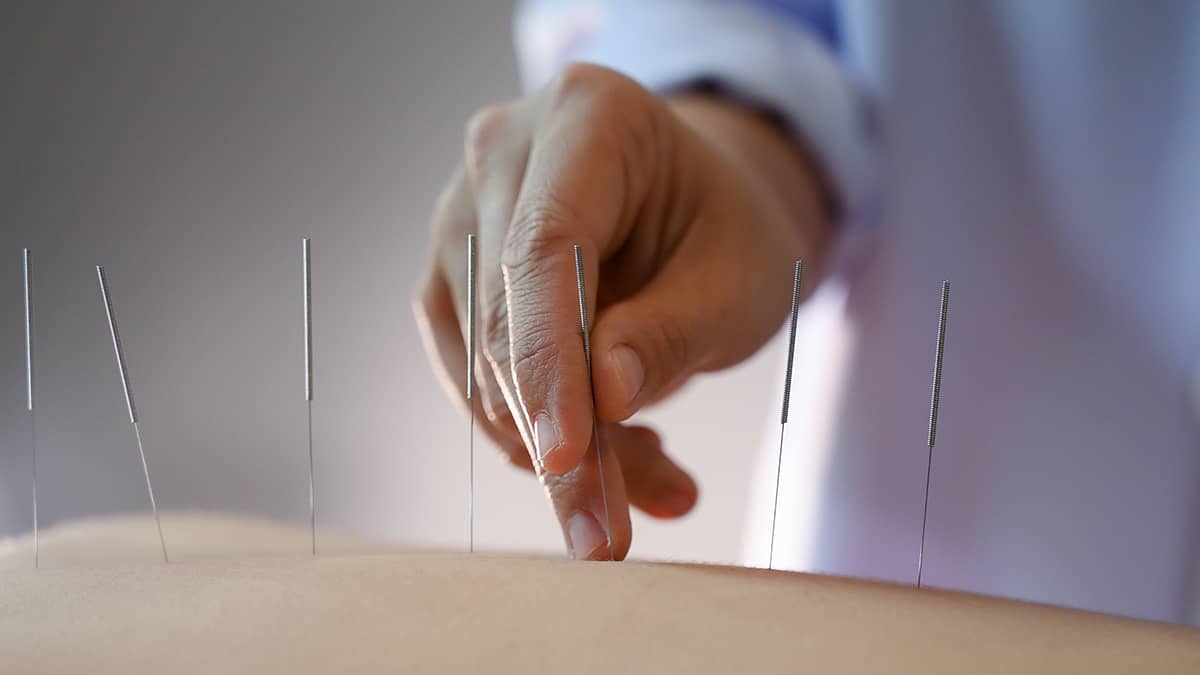 acupuncture women who are the back and acupuncture treatment at salon