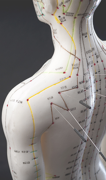 alternative medicine acupuncture concept model