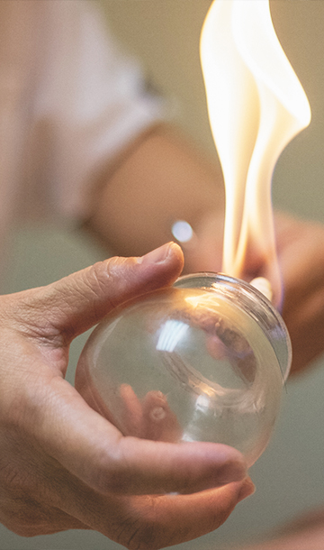 preparing glass cup with flame for cupping therapy